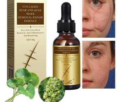 Pei Mei Collagen Scar And Acne Mark Removal Repair Essence