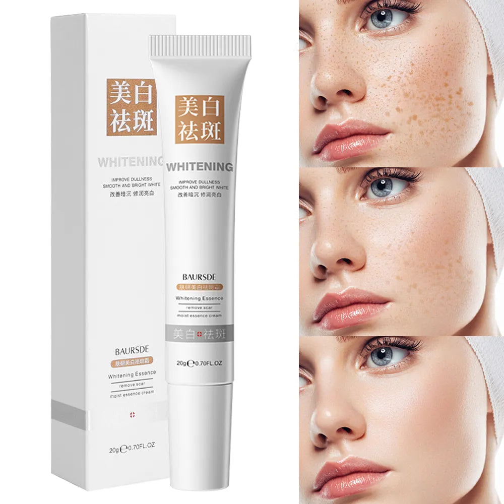 Whitening Freckle Removal Cream Remove Melasma Fade Melanin Anti-Pigmentation Improve Dullness Brighten Skin Care