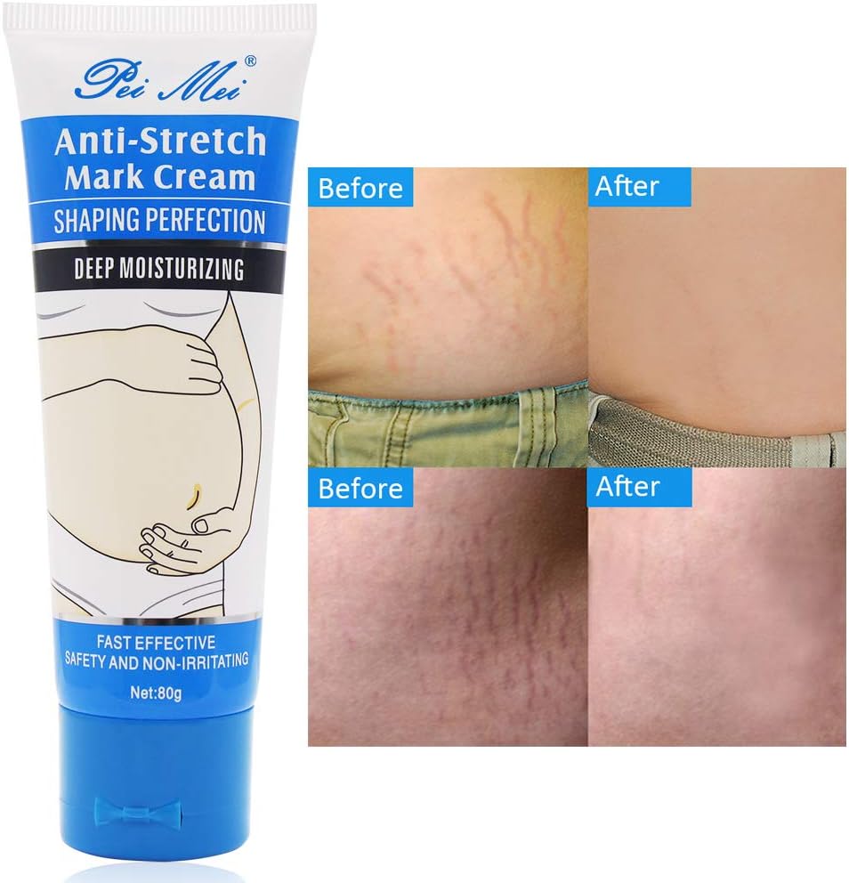 Stretch Mark Cream, Stretch Mark Remover, Stretch Mark Cream Pregnancy, Stretch Mark Removal Cream Maternity Repair, Repair Scar Cream Slackline Abdomen for All Skin Types (PRIVATE)