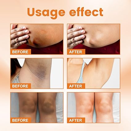 Sadoer Vitamin C Cream 3 in 1, Moisturizing Skincare Underarm Cream, Hyaluronic Acid Body Corrector Cream, Skin Tone Even Cream for Armpit, Neck, Knees, Elbows, Inner Thigh, Private Parts  (private)