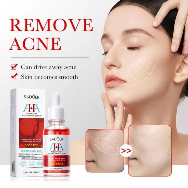 Sadoer Acne Repair Essence Face Serum 40ml