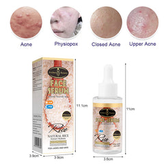 Aichun Beauty Moisturizing, Brightening and Anti Acne Rice Face Serum