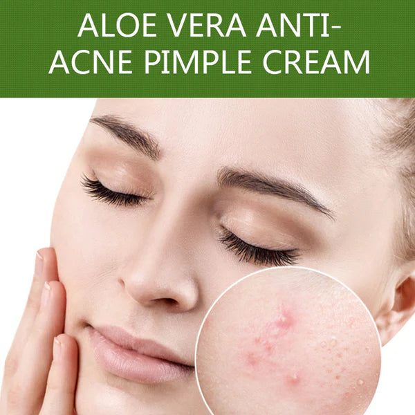 Dr Rashel Aloe Vera Anti acne Pimple Cream, 30g