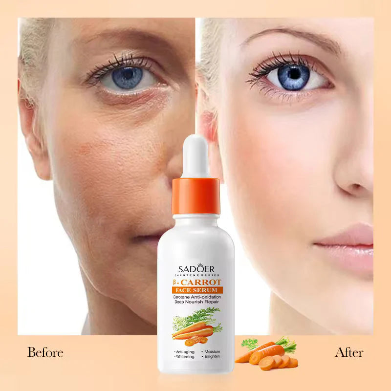 SADOER Carotene Soothing And Repairing B-Carrot Face Serum 15ml