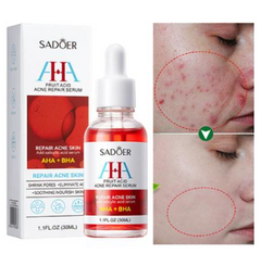 Sadoer Fruit Acid AHA Plus BHA Acne Repair Serum- 30ml