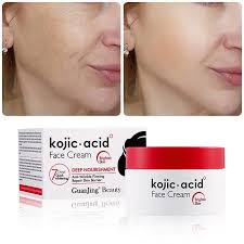 kojic acid face cream