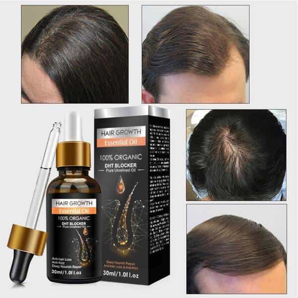 Original Hair Growth Essential Oil 30ml