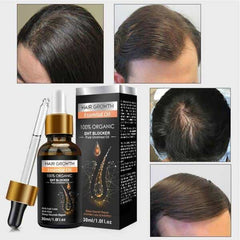 Original Hair Growth Essential Oil 30ml